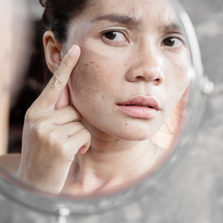 Spotting the Difference: What Kind of Discoloration Is It?